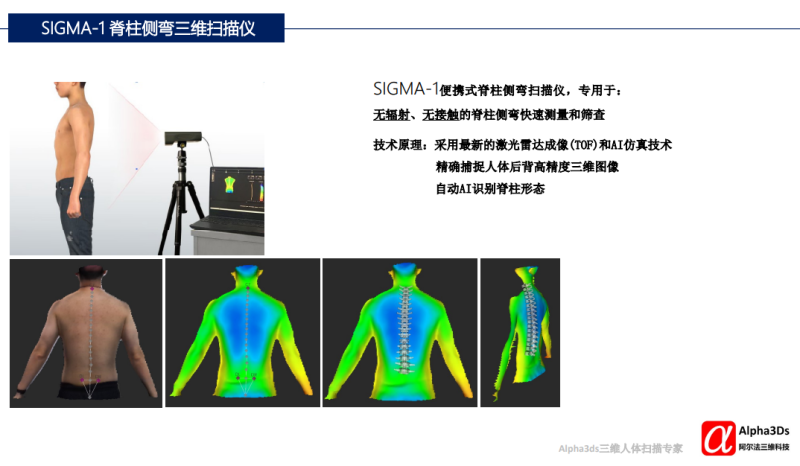 SIGMA-1 便攜式脊柱側(cè)彎三維掃描儀-