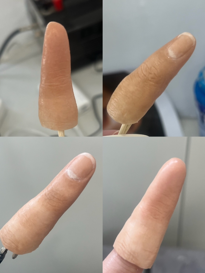 prosthetic finger
