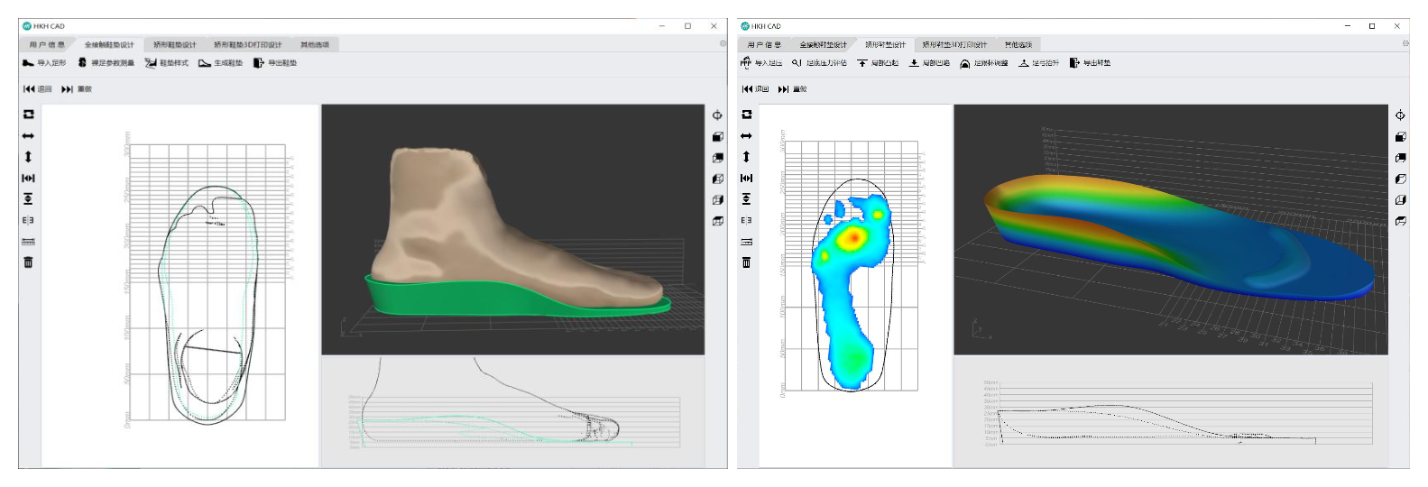 矯形鞋墊快速設(shè)計(jì)軟件